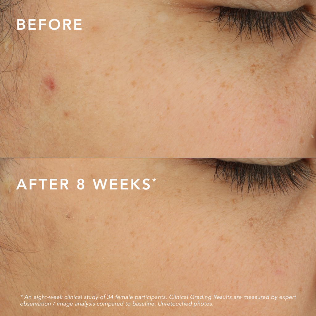 c-bright-dark-spot-corrector